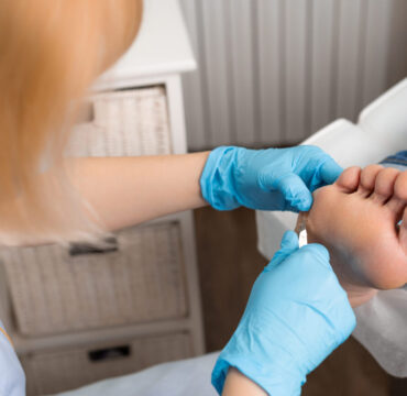 La podología para personas mayores en Málaga requiere un cuidado especializado, ya que con la edad los pies pierden elasticidad, presentan durezas con mayor frecuencia y pueden aparecer problemas como uñas engrosadas, callos dolorosos o dificultades para caminar con normalidad.